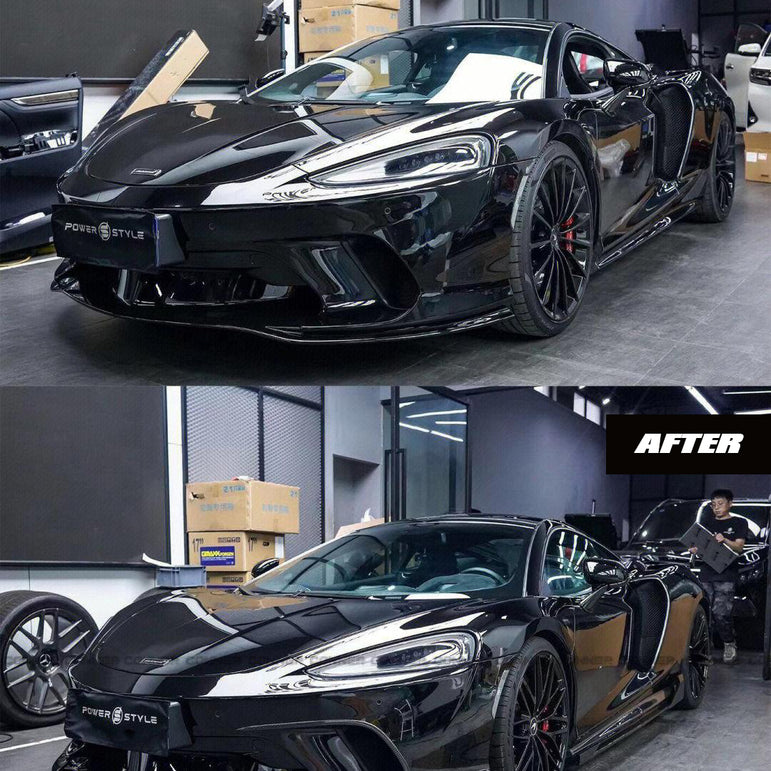 McLaren GT MiW AMANS Full Gloss Prepreg Carbon Aerodynamics Kit