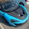 SD Carbon McLaren 540C 570S Full Prepreg / Dry Carbon P1 / Senna Style Bonnet Aftermarket Carbon Fiber Part / Bodykit - Robot Bodykits